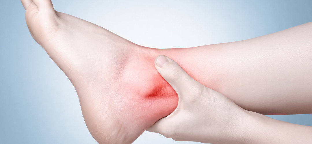 Why So Many People Struggle with Plantar Fasciitis — and What We’re Getting Wrong